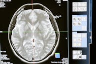 Intricate MRI brain scan displayed on a computer screen for medical analysis and diagnosis.